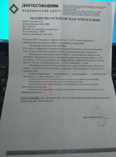 12.07.2019 год. МРТ Наружная гидроцифалия. Полисинусит..png