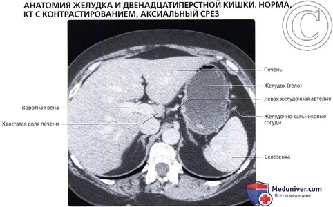 rentgen_kt_anatomia_geludka_dvenadcatiperstnoi_kishki-12.jpg